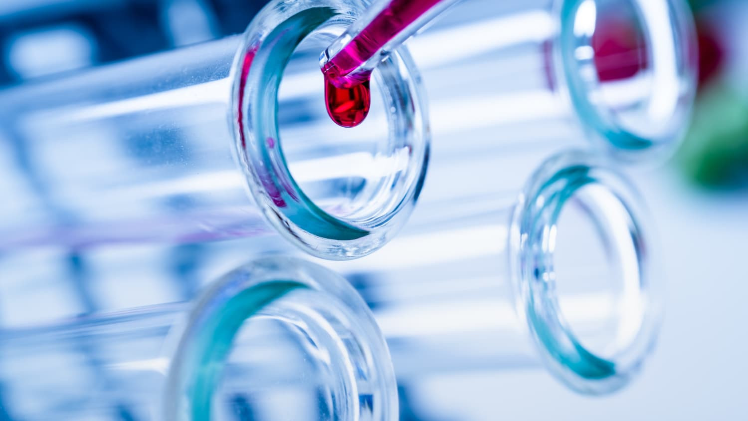 Azərbaycanda 2468 nəfər COVID-19-a yoluxub