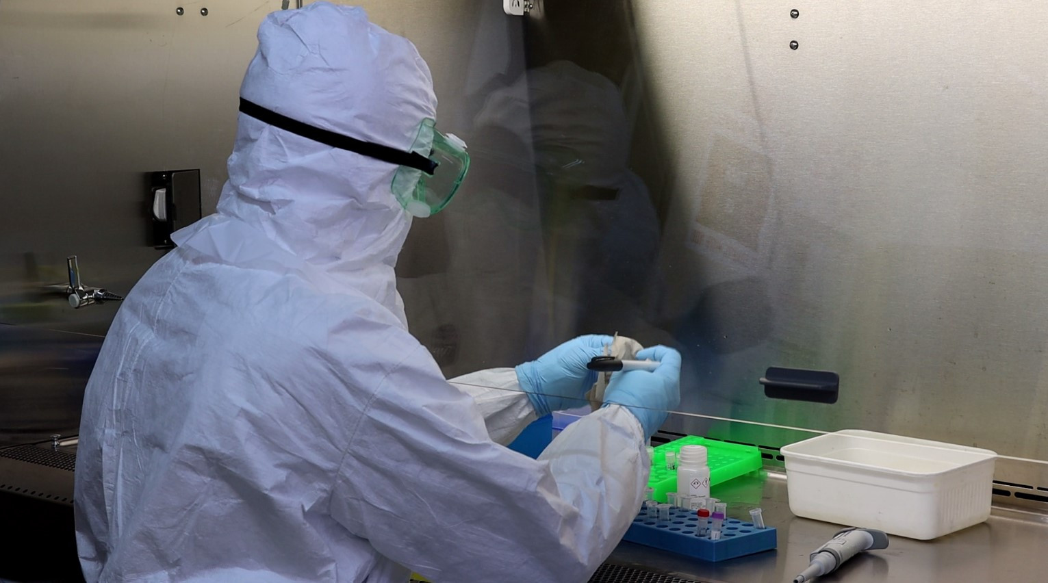 Azərbaycanda daha 5 min 948 nəfər COVID-19-a yoluxub