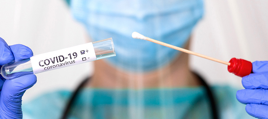 Azərbaycanda son sutkada 24 nəfər COVID-19-dan vəfat edib