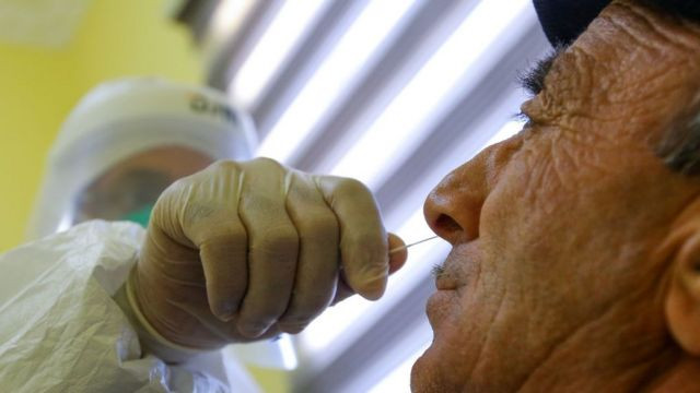 Son sutkada koronavirusa 53 nəfər yoluxub