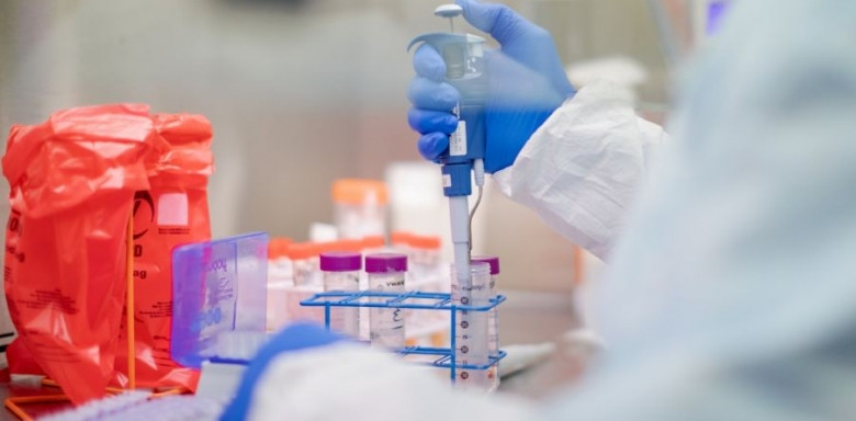 Azərbaycanda COVID-19-a daha 78 yoluxma faktı qeydə alınıb