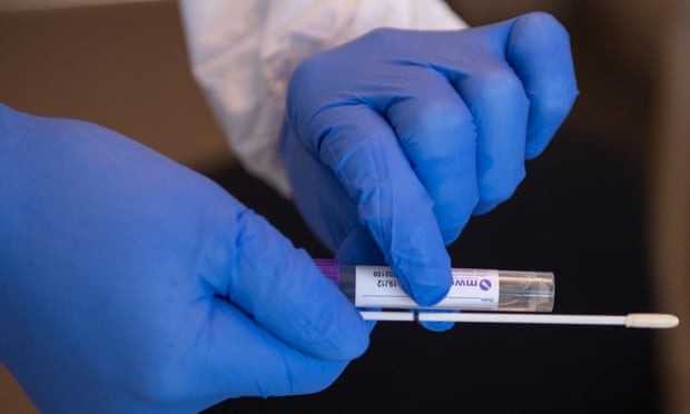 COVID-19 infeksiyasına 48 yoluxma faktı qeydə alınıb