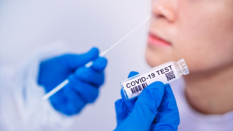 Azərbaycanda daha 588 nəfər COVID-19-a yoluxub: 15 nəfər vəfat edib