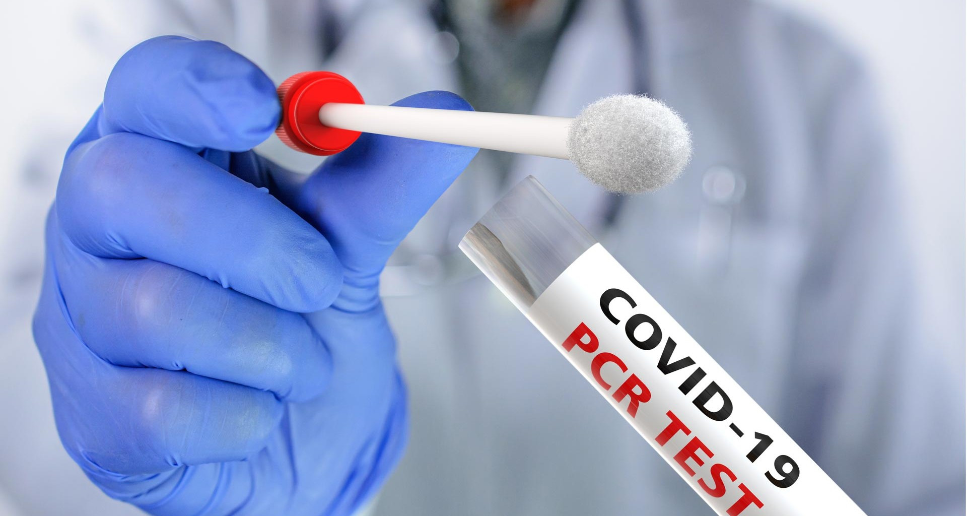 Azərbaycanda daha 33 nəfər COVID-19-a yoluxub