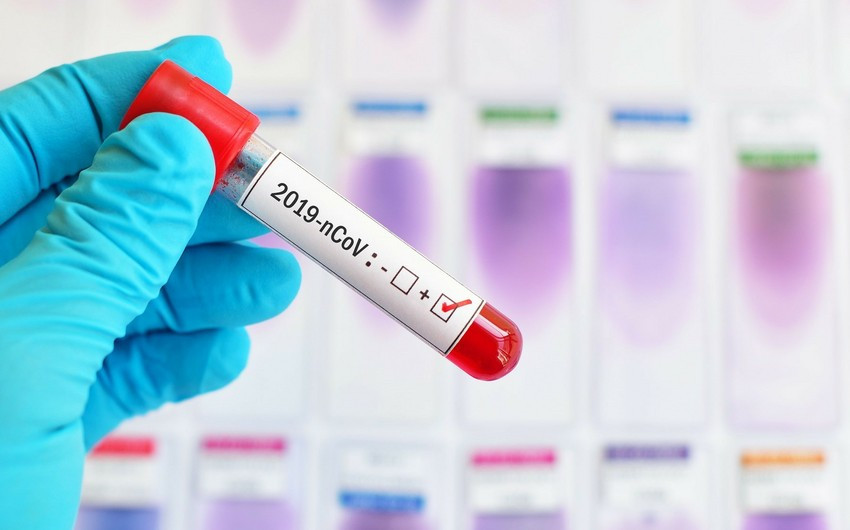 Azerbaijan confirms 13 COVID-19 infections on April 29