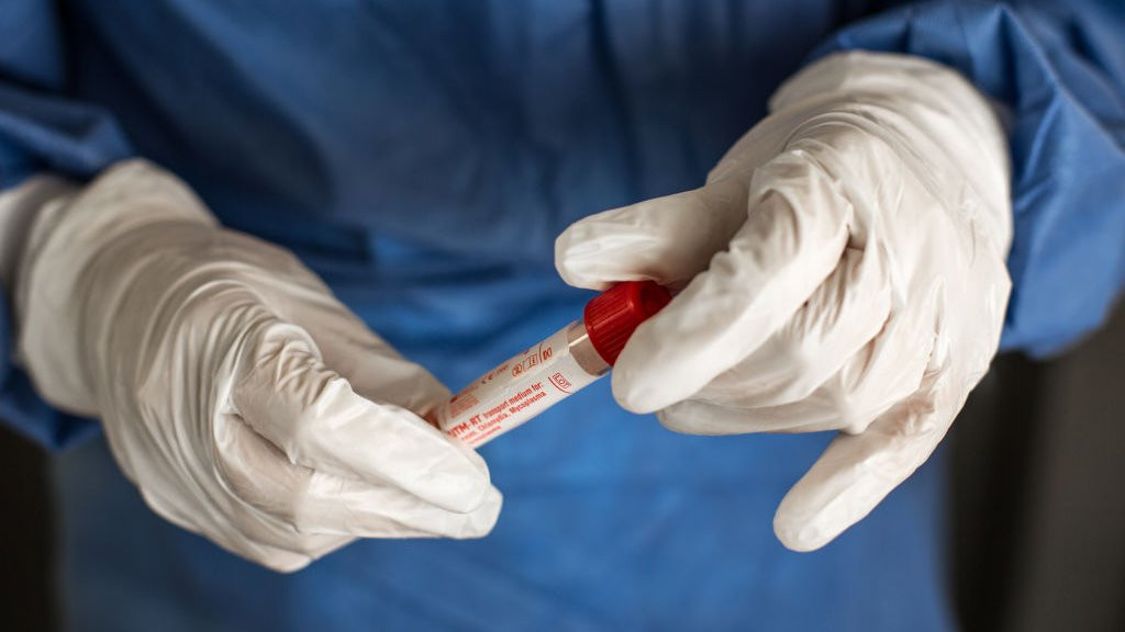 Azərbaycanda daha 13 nəfər COVID-19-a yoluxub