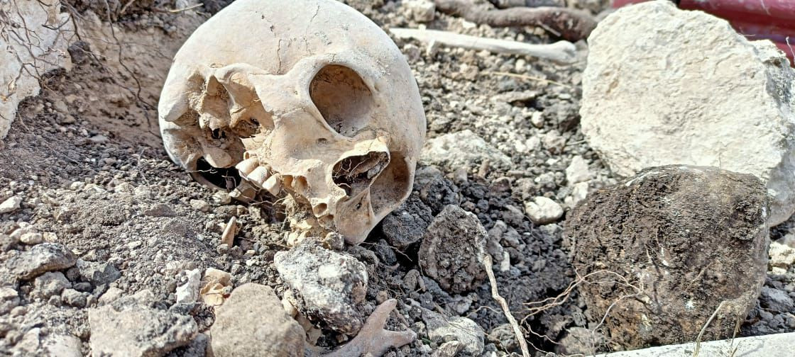 Qarabağda kütləvi məzarlıqlardakı meyit qalıqları ekshumasiya edildi