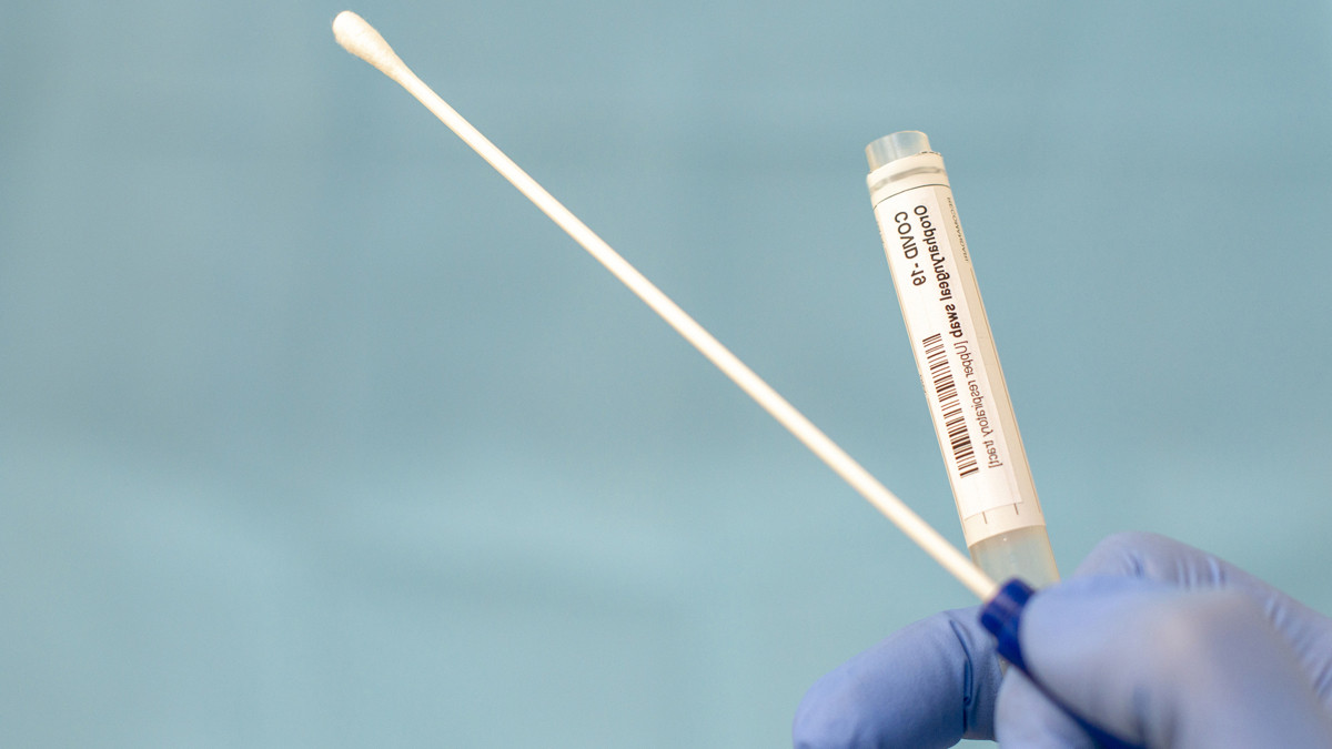 Azərbaycanda daha 72 nəfər COVID-19-a yoluxub