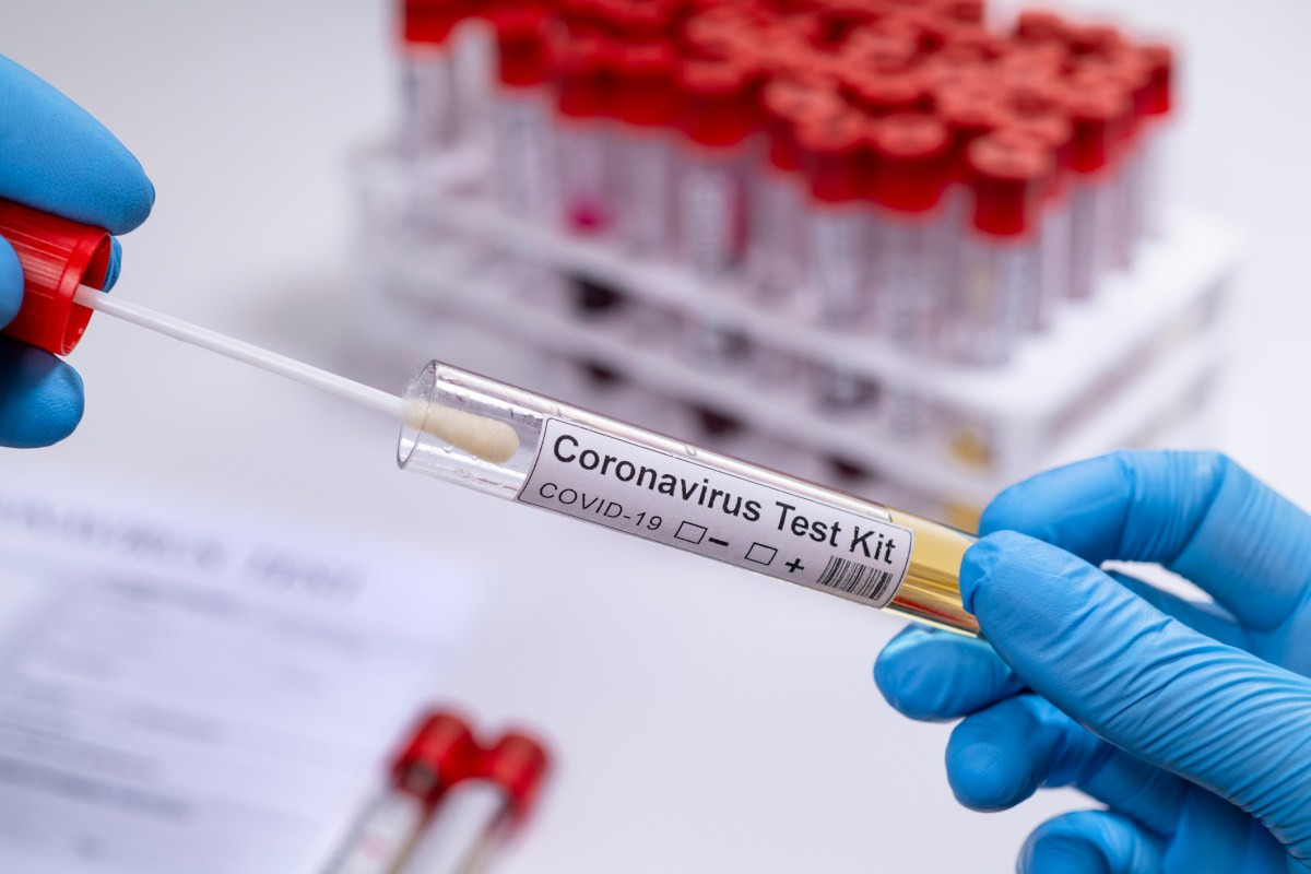 В Азербайджане за последние сутки коронавирусом заразились 396 человек