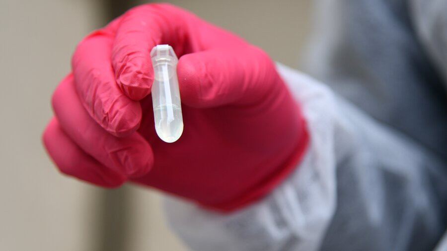 Azərbaycanda koronavirusa yoluxan üç nəfər vəfat edib