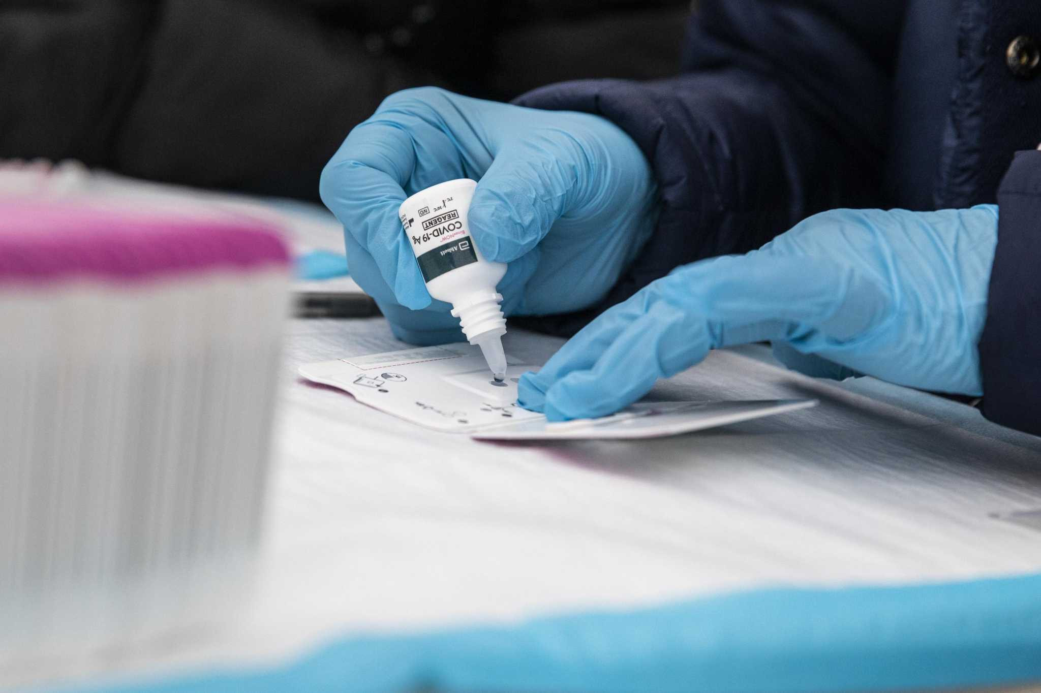 Azərbaycanda 140 nəfər koronavirusa yoluxub