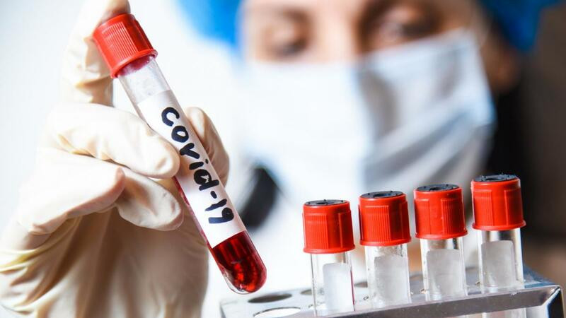 В Азербайджане за последние сутки зарегистрировано 149 фактов заражения коронавирусом