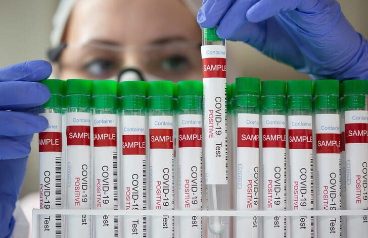 В Азербайджане за последние сутки зарегистрировано 129 фактов заражения коронавирусом