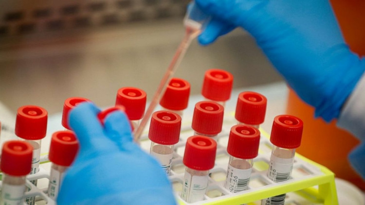 Azərbaycanda COVID-19-a yoluxanların sayı açıqlanıb