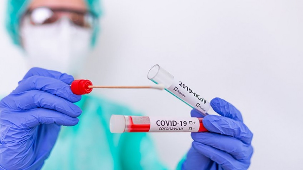 Azərbaycanda daha 3 nəfər COVID-19-a yoluxub