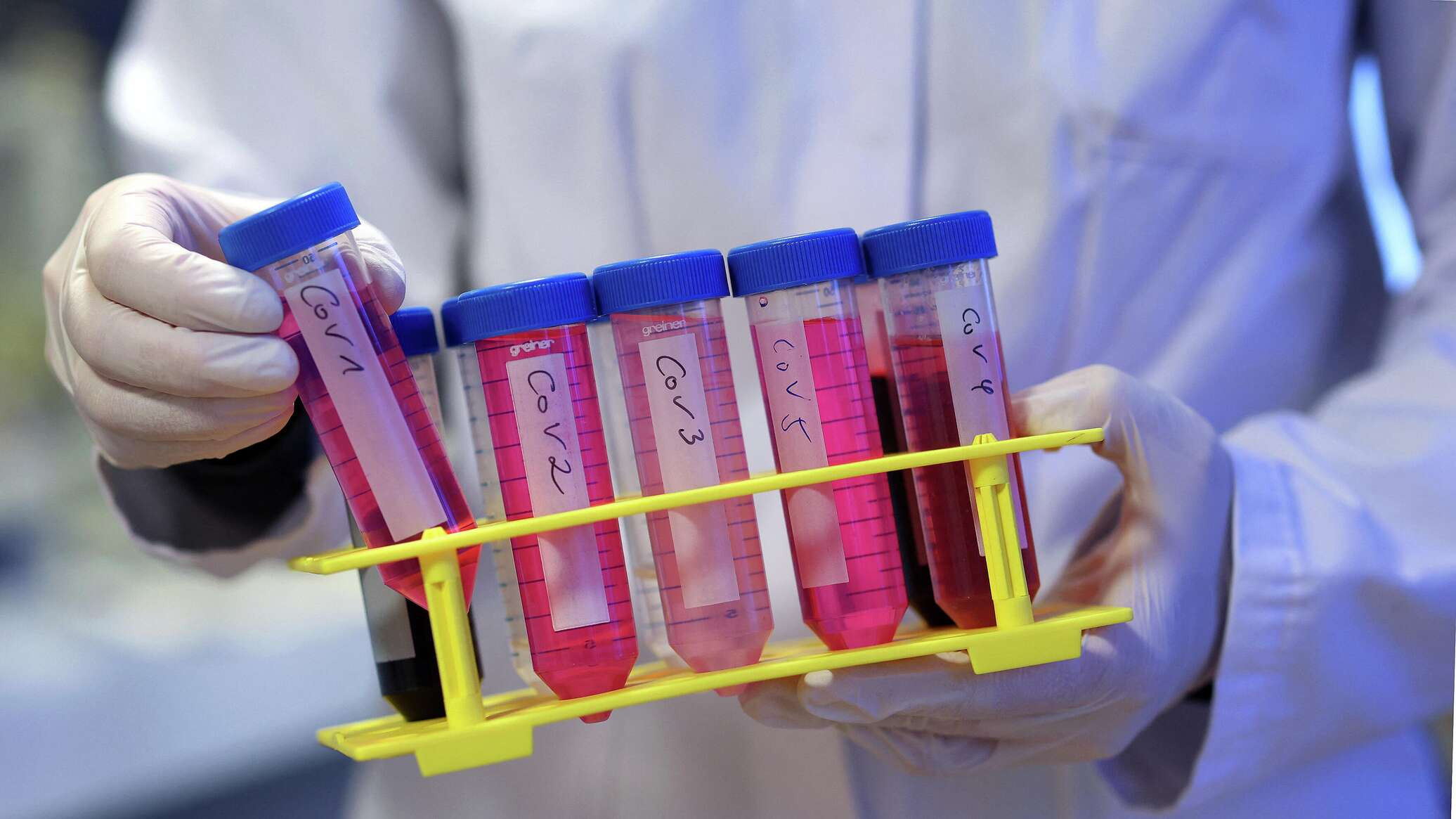 Azerbaijan logs 11 new COVID-19 cases