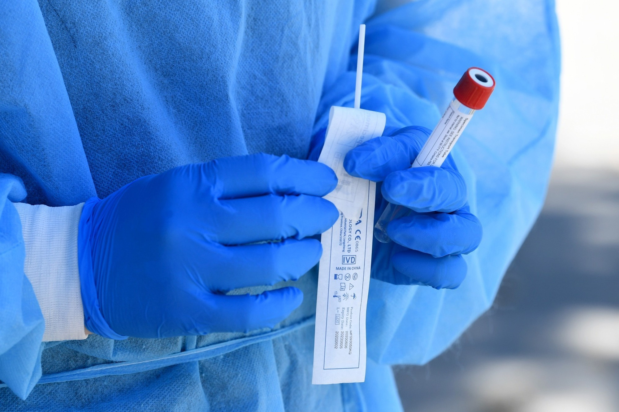 Son sutkada Azərbaycanda COVID-19 infeksiyasına 12 yoluxma faktı qeydə alınıb