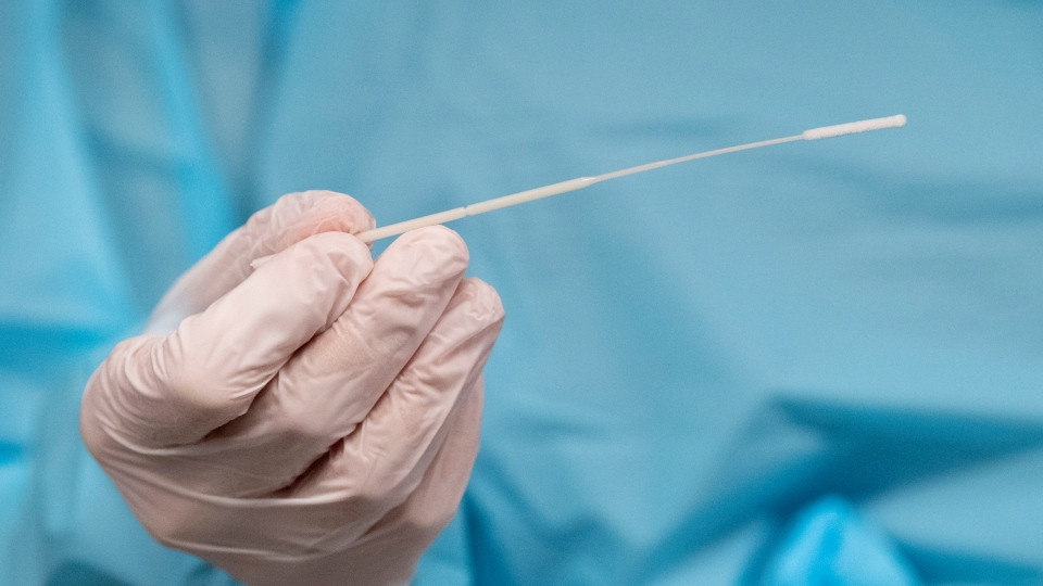 Azərbaycanda COVID-19 infeksiyasına 36 yoluxma faktı qeydə alınıb