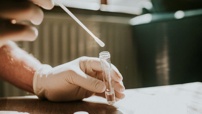 В Азербайджане за последние сутки коронавирусом заразились 37 человек