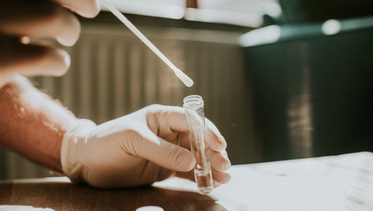 Azərbaycanda daha 277 nəfər COVID-19-a yoluxub