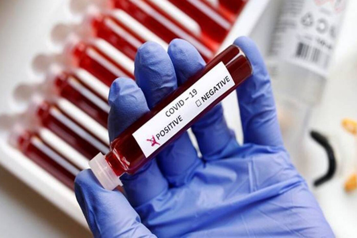 Azərbaycanda COVID-19-a yoluxma sayı açıqlanıb