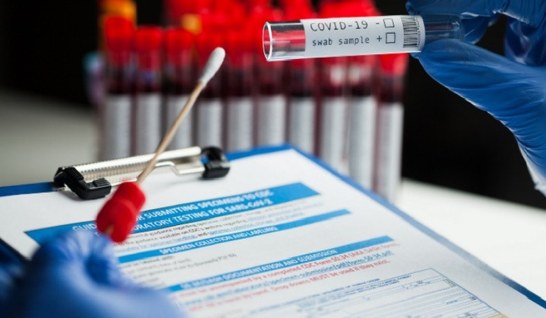 Azərbaycanda koronavirusa yoluxanların sayı kəskin artdı, ölənlər var