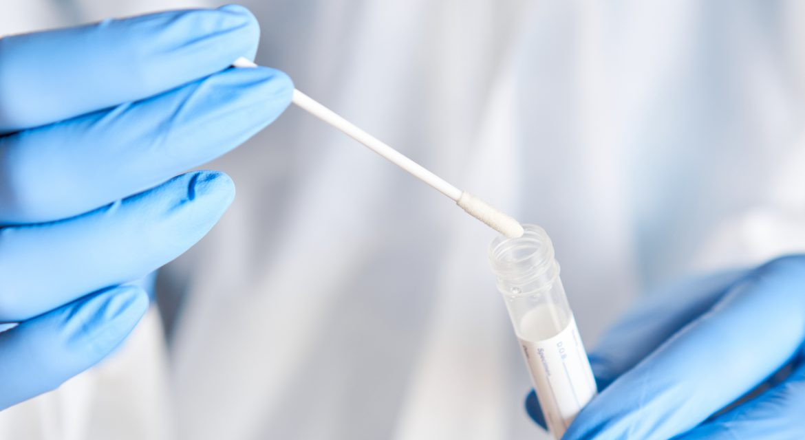 В Азербайджане за последние сутки коронавирусом заразились 36 человек