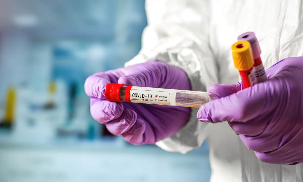 Azərbaycanda bir nəfər COVID-19-dan ölüb