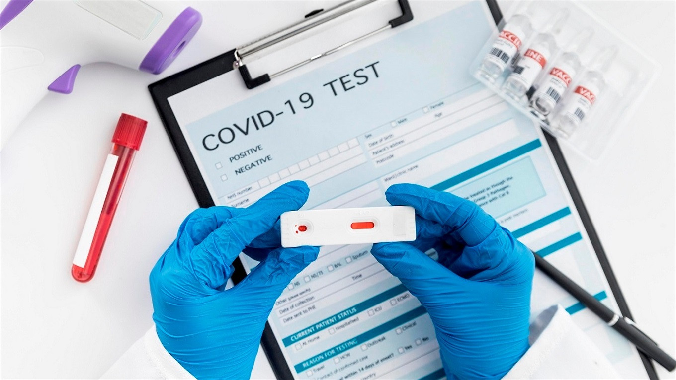 Azərbaycanda daha 420 nəfər COVID-19-a yoluxub: <mark>5 nəfər vəfat edib<mark>