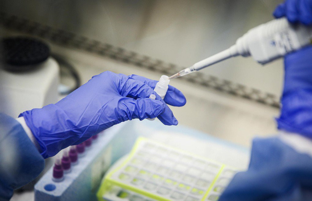 Son sutkada Azərbaycanda COVID-19 infeksiyasına 69 yoluxma faktı qeydə alınıb