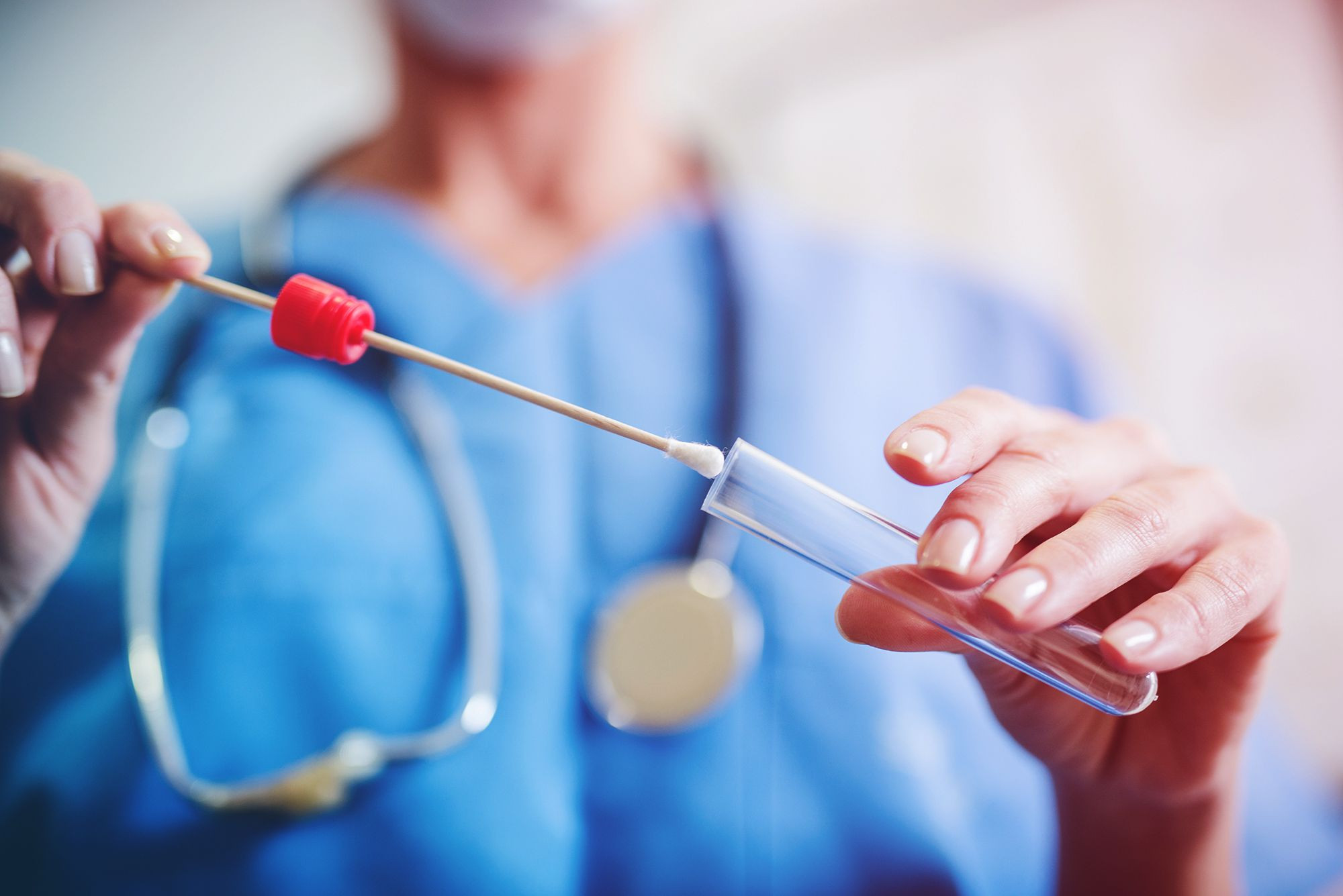 Azərbaycanda 90 nəfər koronavirusa yoluxub