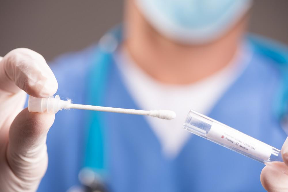 Son sutkada Azərbaycanda COVID-19 infeksiyasına 60 yoluxma faktı qeydə alınıb