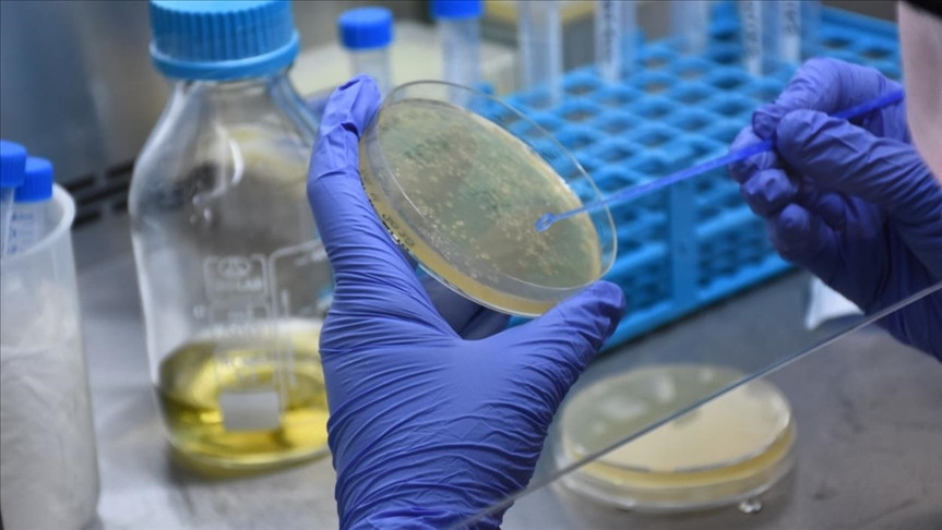 Azərbaycanda COVID-19 infeksiyasına 51 yoluxma faktı qeydə alınıb