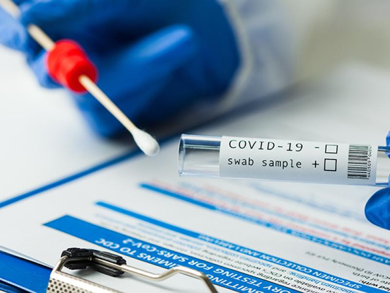 В Азербайджане за последние сутки коронавирусом заразились 84 человека