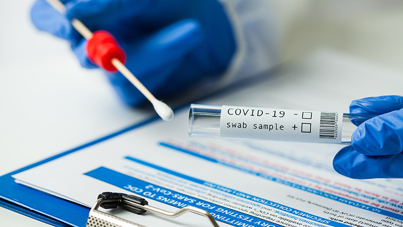 В Азербайджане за последние сутки коронавирусом заразились 22 человека